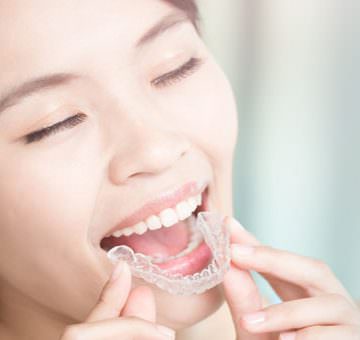 Living With Invisalign Treatment