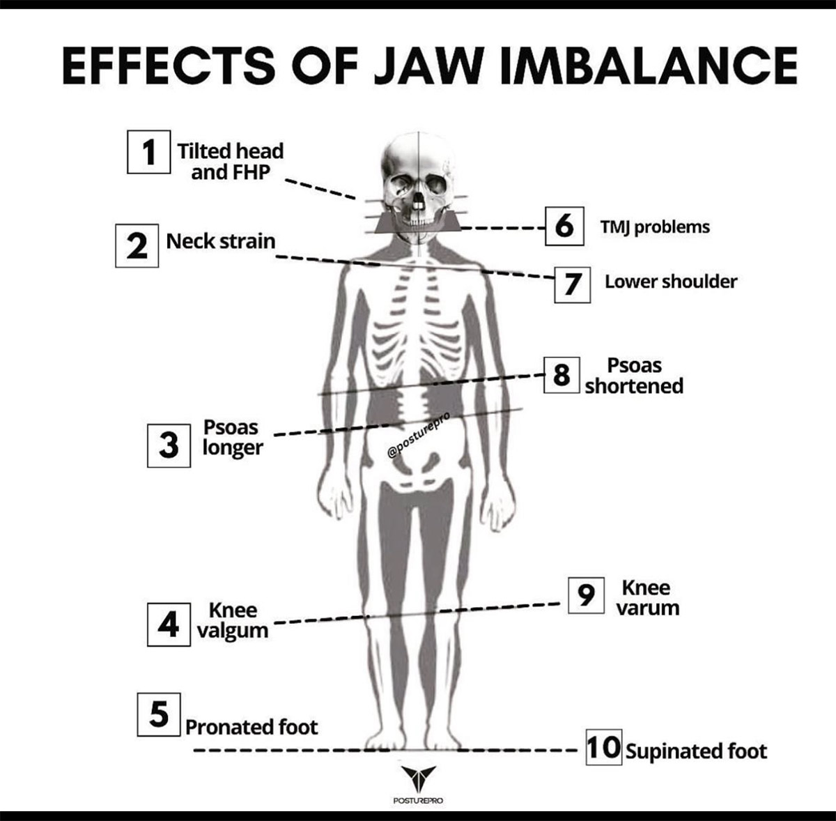 Effects of the Jawbone - Please contact us if you are having trouble seeing this image.